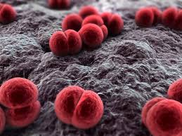 meningite