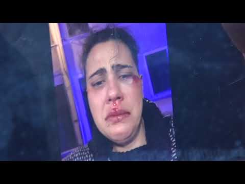Zia e nipote aggredite e picchiate a Bolsena, 